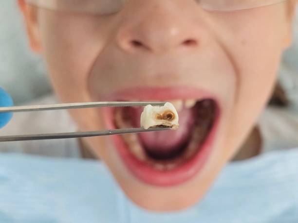 Best 24-Hour Emergency Dentist in Marceline, MO